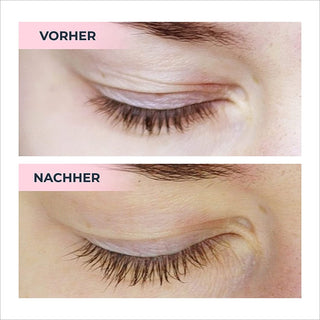 Superlative Lash Eyelash Serum
